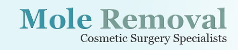 Mole Removal Mole Removal
