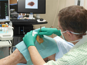 Mole Removal in Manchester